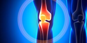 American Orthopedics Partial Meniscectomy + Meniscal Repair hero