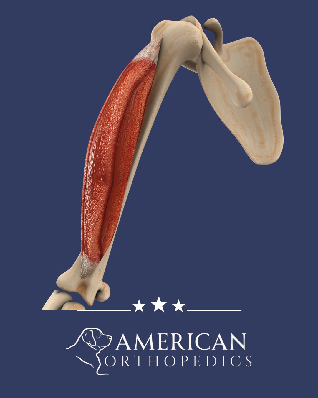 Biceps Tendonitis Treatment sub-service box American Orthopedics Greenville, SC